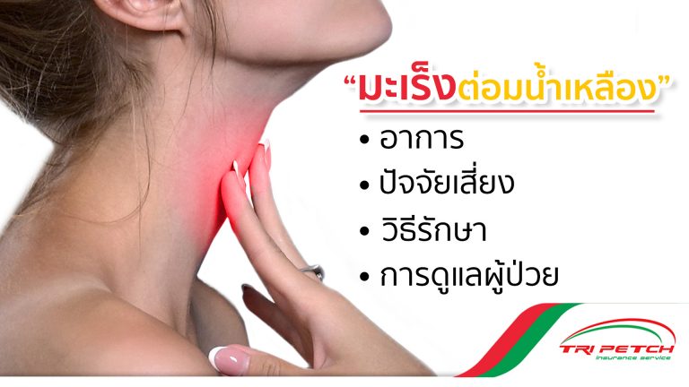 มะเร็งต่อมน้ำเหลือง