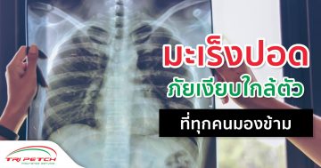 มะเร็งปอดภัยเงียบใกล้ตัว ที่ทุกคนมองข้าม